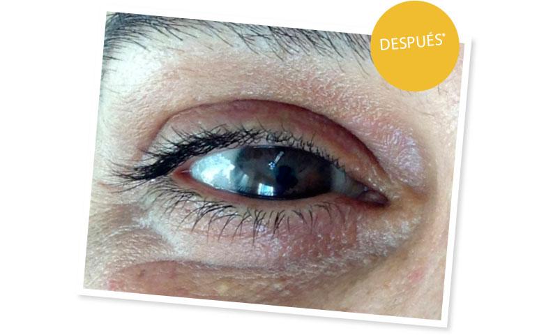 Hola mamá - Xantelasmas - Después